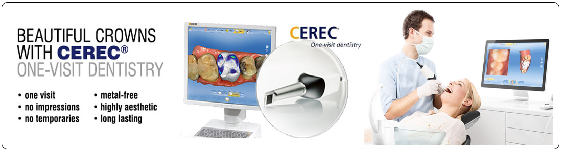 Cerec - One visit dentistry