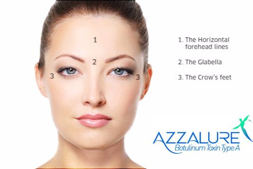 azzalure